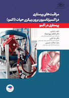 مراقبت های پرستاری در اکسیژناسیون برون پیکری حیات (اکمو)